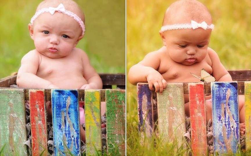 Află istoria gemenelor născute cu pielea de culoare diferită
