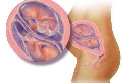 Dezvoltarea intrauterină a gemenilor lună după lună