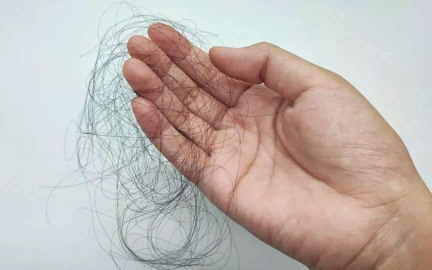 „Ozempic” provoacă căderea părului — studiu