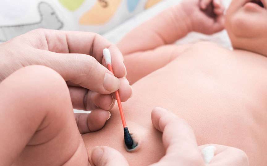Îngrijirea corectă a bontului ombilical la nou-născut: sfaturi de la pediatri