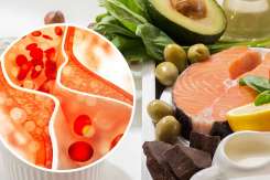 Ce să mănânci când ai colesterolul ridicat — alimente recomandate, dietă și sfaturi medicale