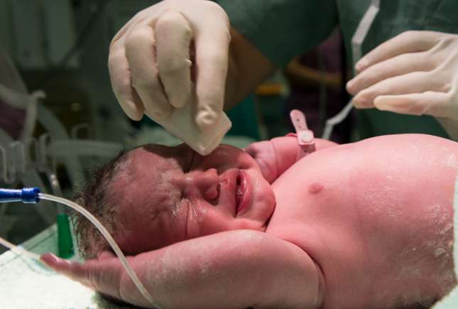 Forma capului nou-născutului – ce este normal și când să mergi la medic