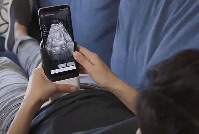 Gravidele vor putea face singure ecografii cu smartphone-ul – noua eră a îngrijirii prenatale