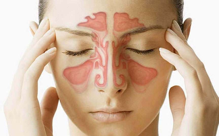 Sinuzita – cauze, simptome și tratament