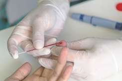 Hematocrit scăzut la copii: cauze, simptome și recomandări medicale