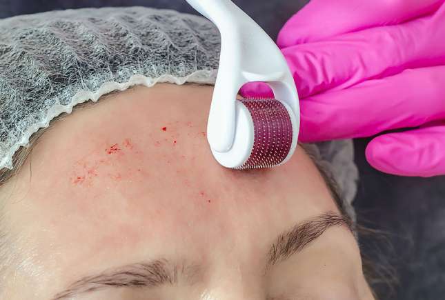 Cele mai periculoase proceduri cosmetologice făcute acasă: ce riscuri ascund trendurile de pe TikTok