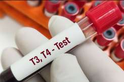 Glanda tiroidă: când și cum trebuie verificată pentru a preveni problemele hormonale