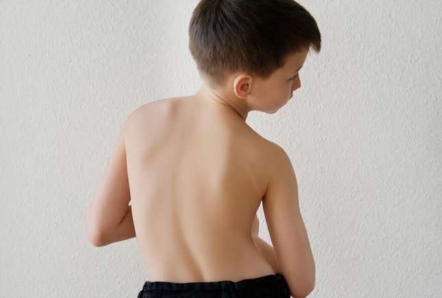 Postura copilului și sănătatea coloanei vertebrale: ce trebuie să știe părinții