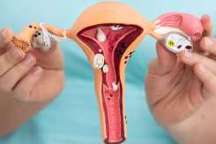 Endometrioza: ce este, cum se tratează și ce trebuie să știe fiecare femeie
