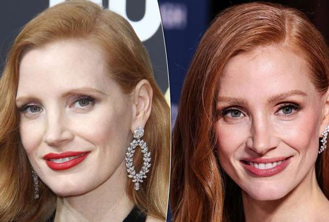 Lifting facial la vedete: 5 exemple de succes și cum arată rezultatele înainte și după