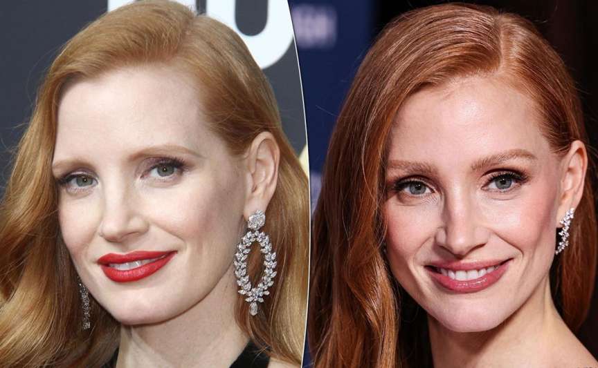 Lifting facial la vedete: 5 exemple de succes și cum arată rezultatele înainte și după
