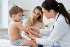 Cicatricile după varicelă la copii – prevenție și tratamente eficiente