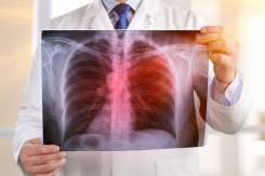 Screening pulmonar gratuit la Strășeni: program pentru 28-30 septembrie