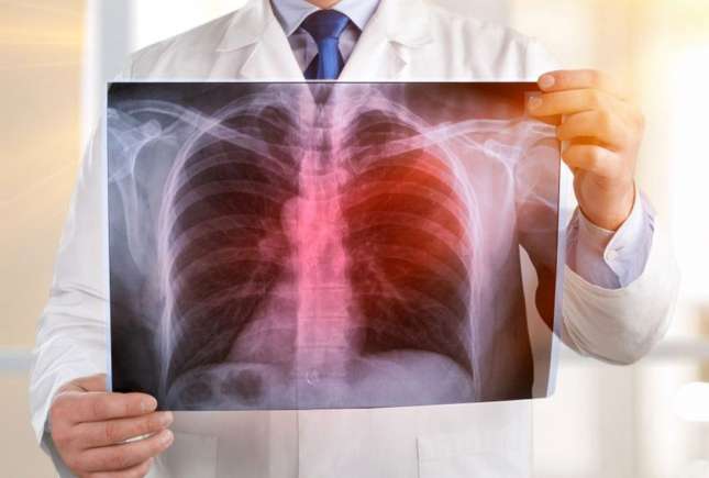 Screening pulmonar gratuit la Strășeni: program pentru 28-30 septembrie
