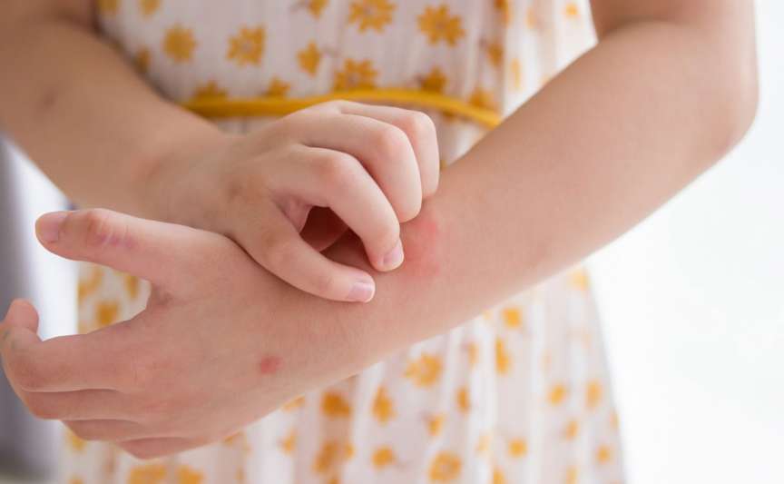 Exantemul viral la copii: cum se recunoaște și cum se tratează