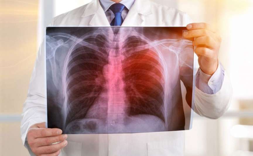 Screening pulmonar gratuit la Strășeni: program pentru 28-30 septembrie